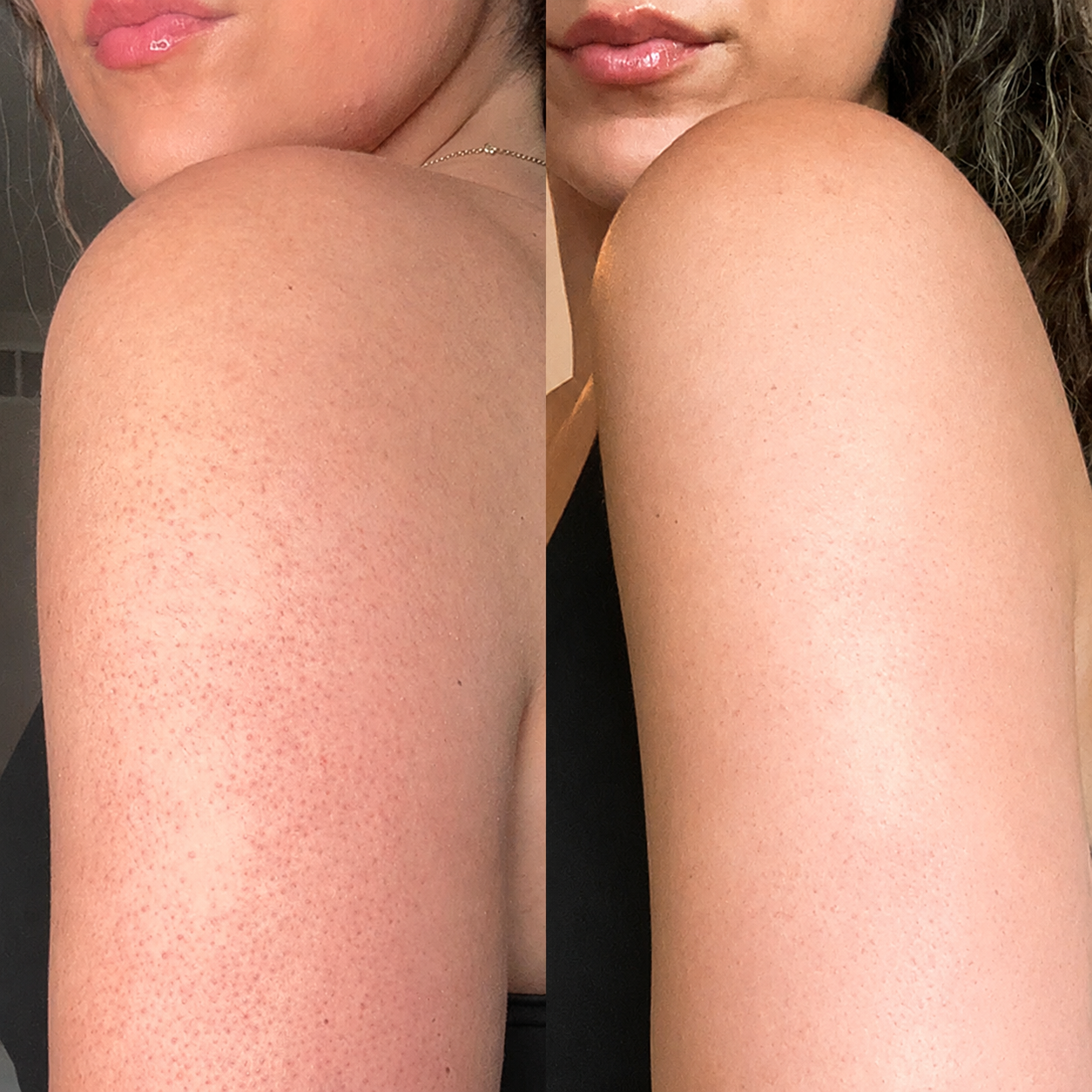 Real Skin, Real Results